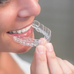invisalign sevilla
