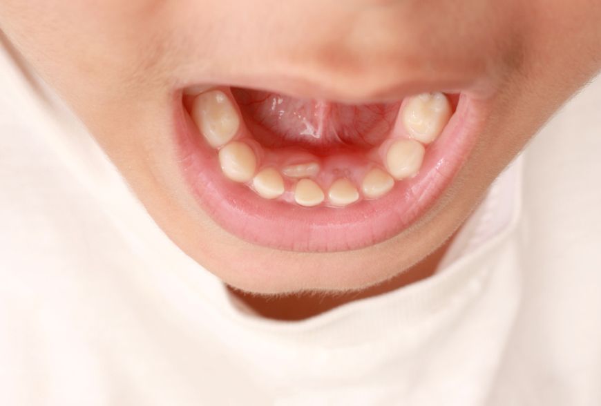 DENTISTA INFANTIL SEVILLA