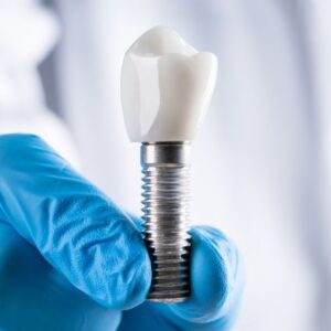 implantes dentales sevilla