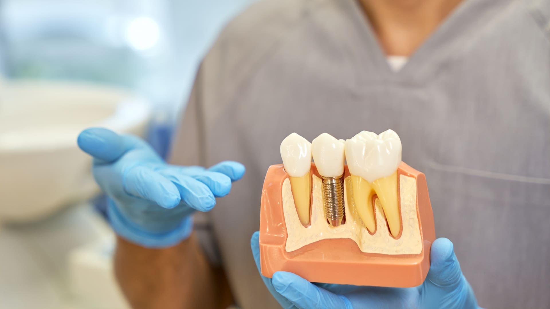 implantes dentales sevilla