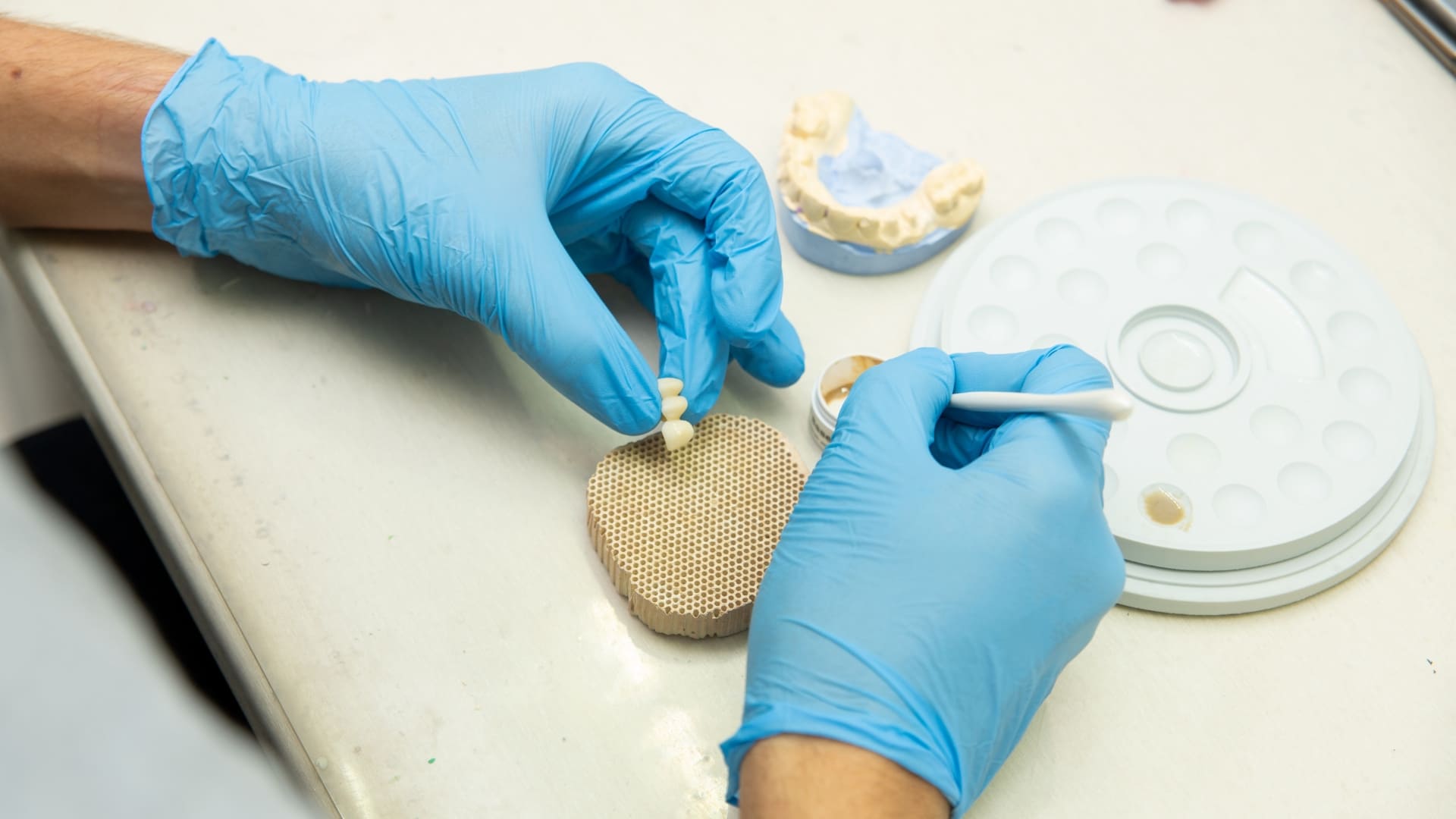 puente dental sevilla
