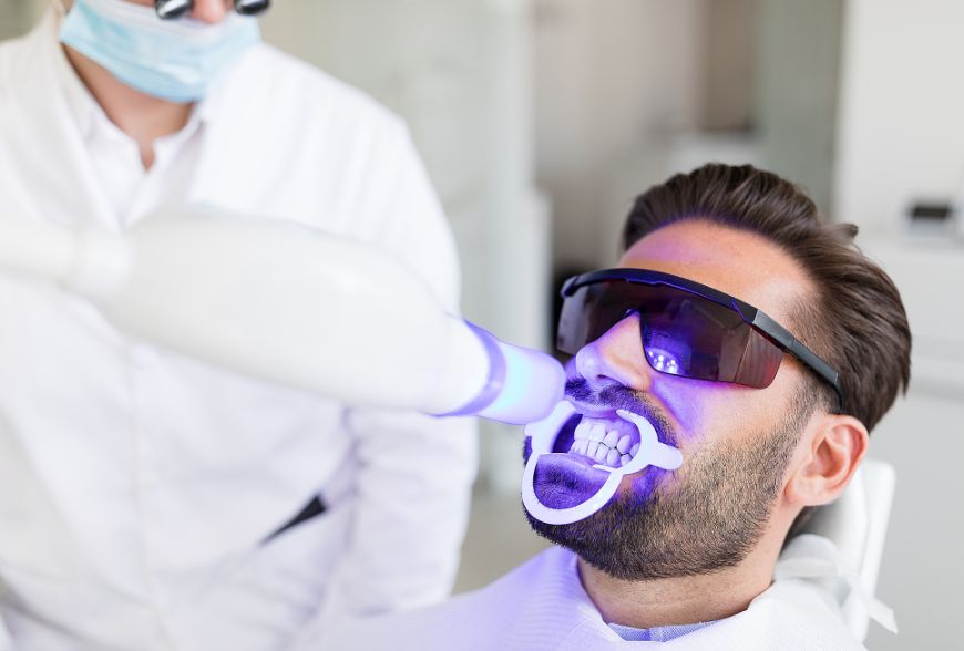 blanqueamiento dental sevilla
