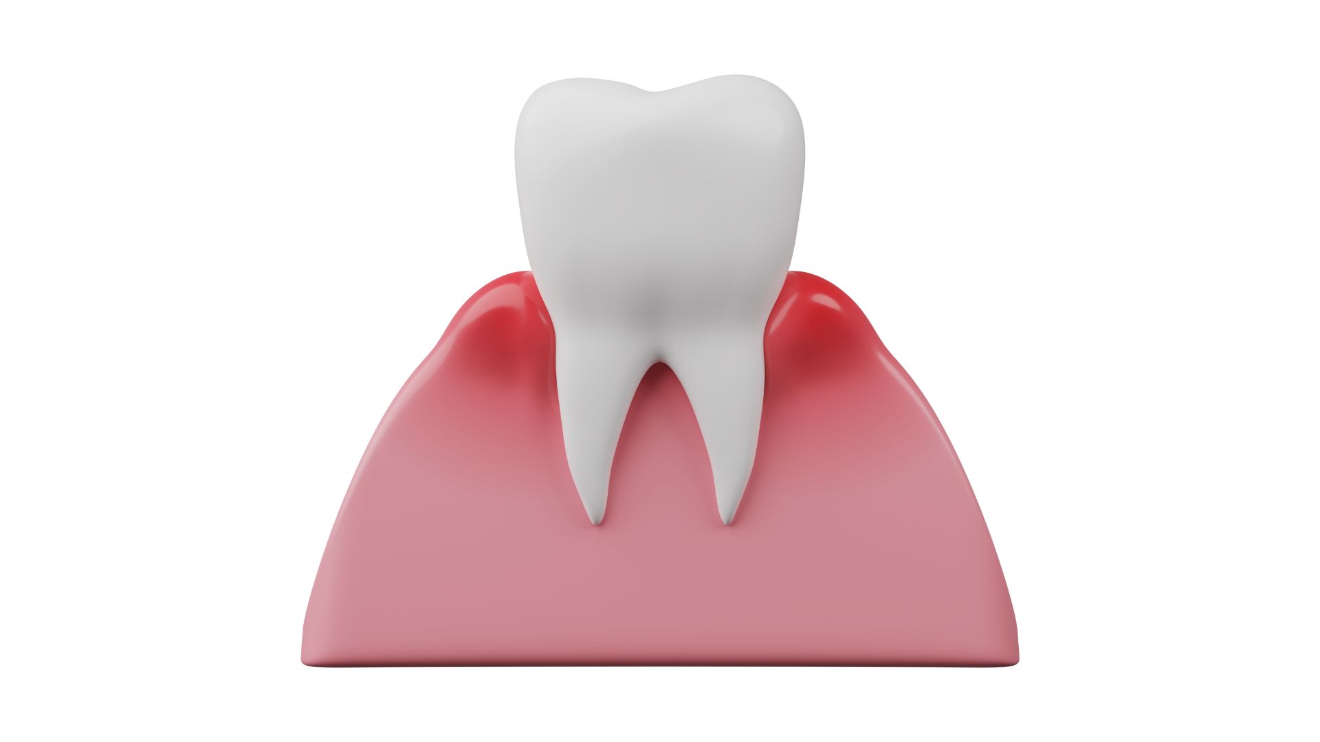 gingivitis sevilla