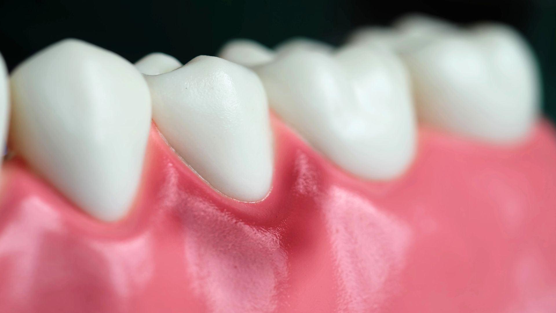periodoncia sevilla