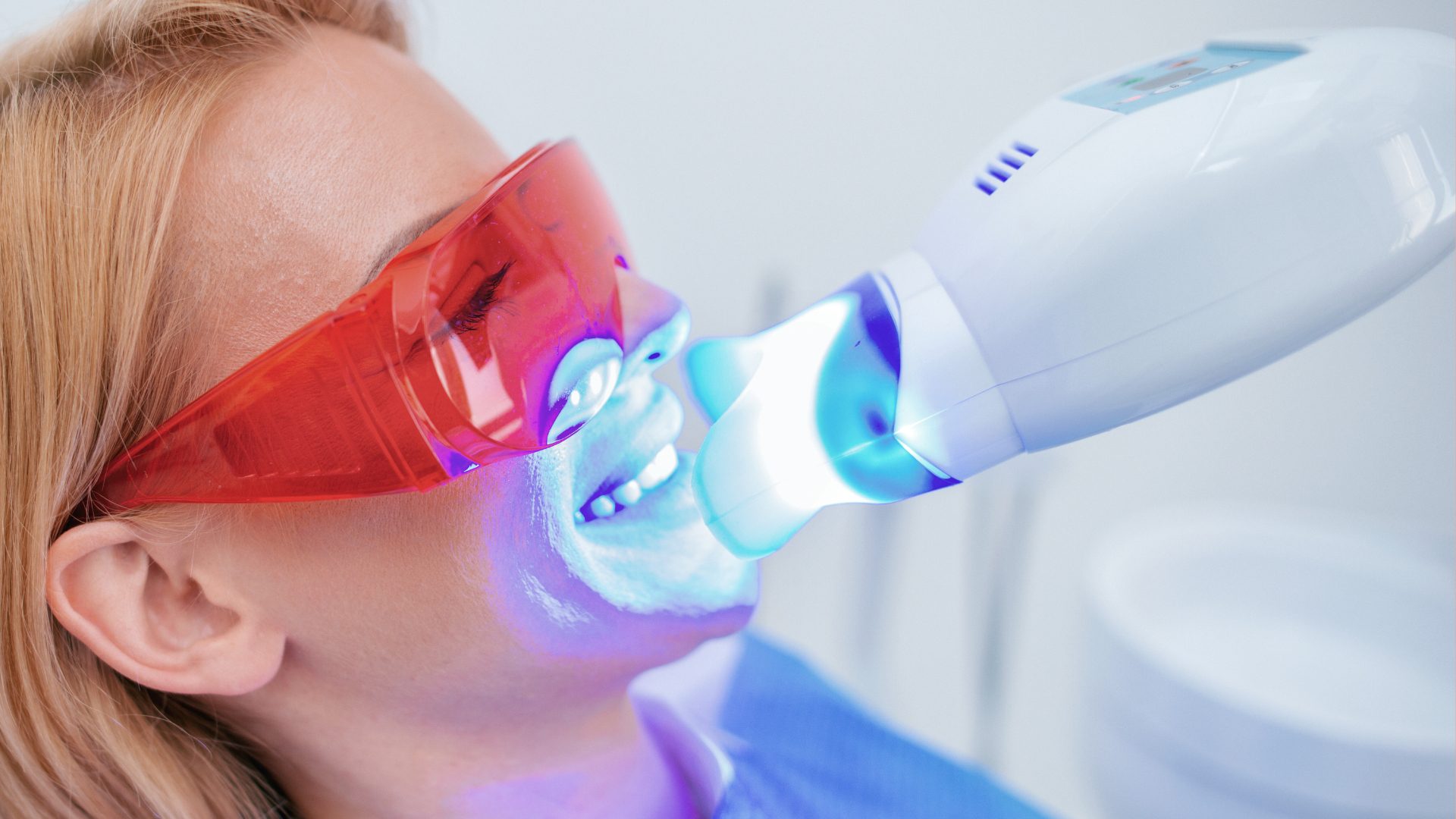 técnica blanqueamiento dental