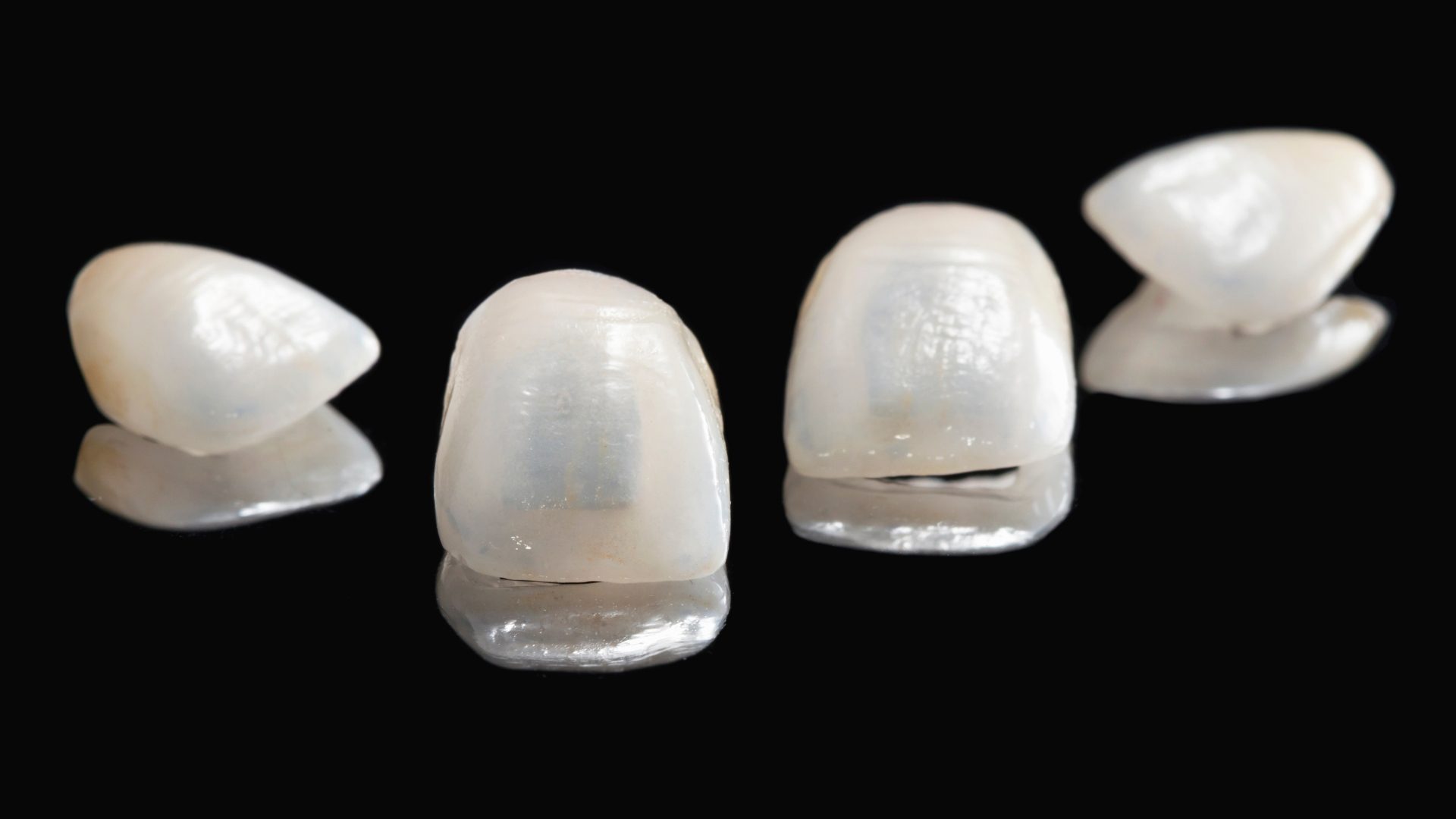 Ejemplos de carrillas dentales