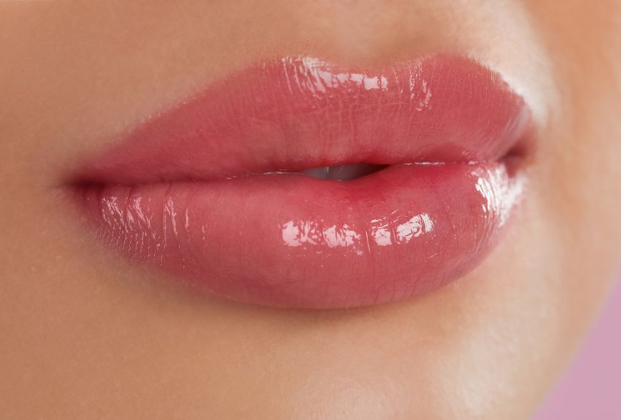 aumento de labios con ácido hialurónico