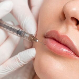 duración del aumento de labios