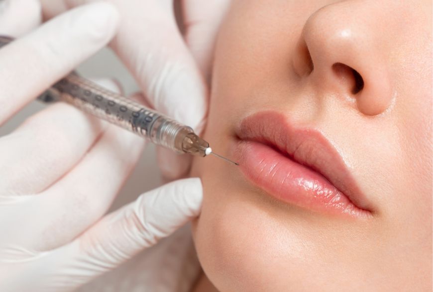 duración del aumento de labios