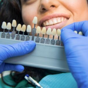 blanqueamiento dental