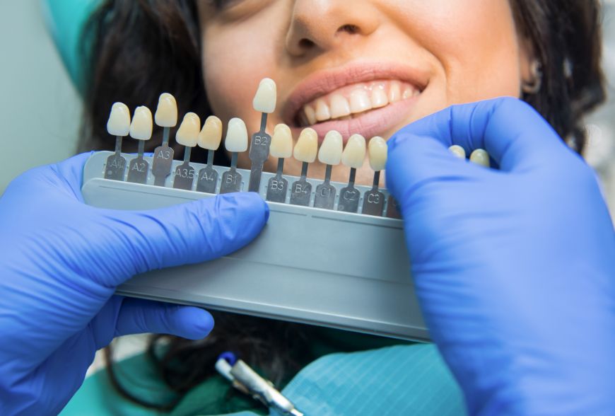 blanqueamiento dental