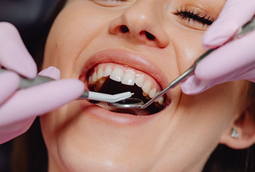 empaste roto sintomas