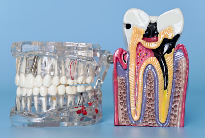 ligamento periodontal
